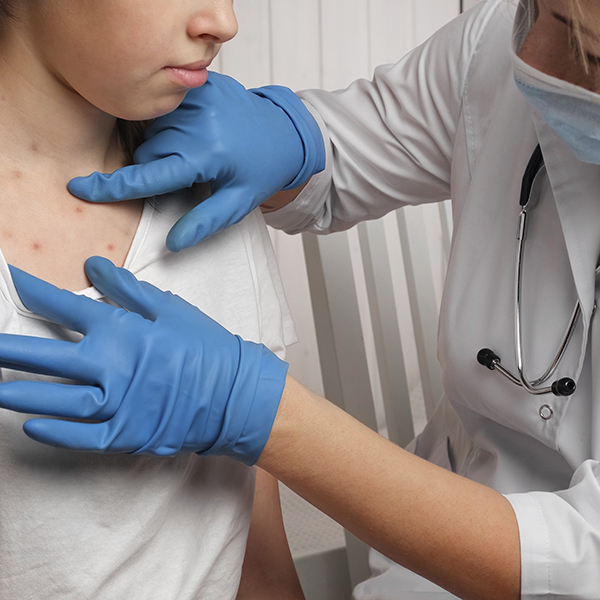 The Resurgence of Measles in 2025